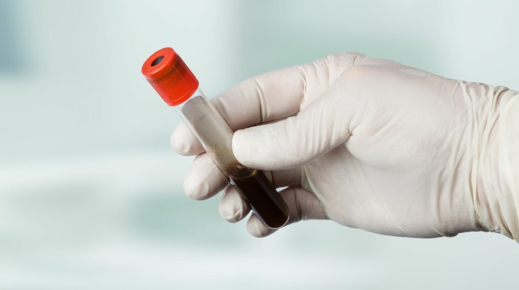 how to increase hemoglobin